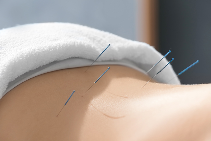 Medical Acupuncture Hampshire Injury & Health
